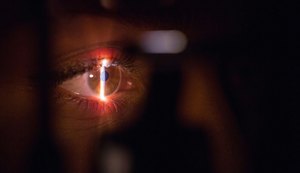 Oftalmologista da Hapvida NotreDame Intermédica alerta para os riscos do glaucoma