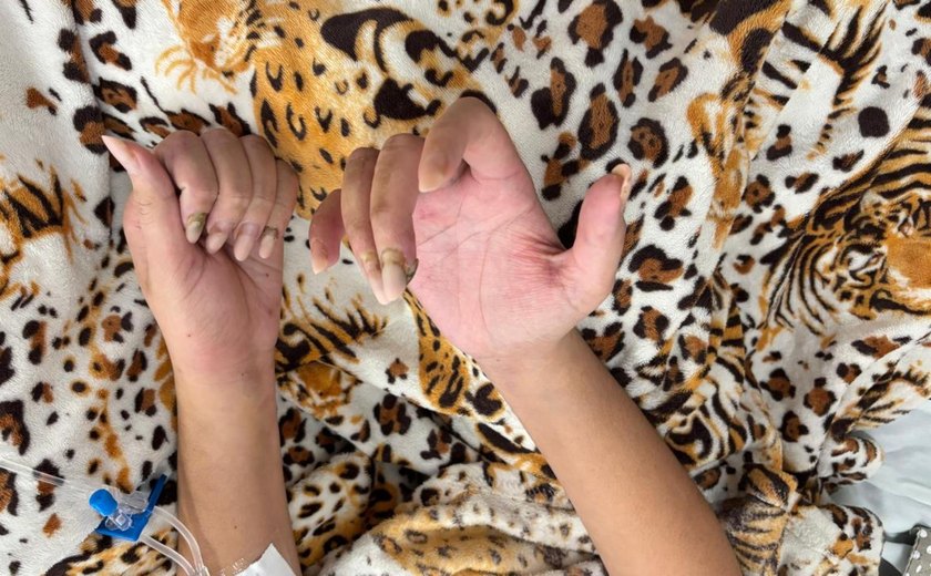 Jovem diagnosticada com endocardite infecciosa após colocar unhas em gel se recupera bem no Hospital Metropolitano