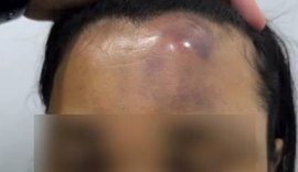 SSP abre investigação sobre denúncia de agressão policial durante festa de São Pedro em Maceió