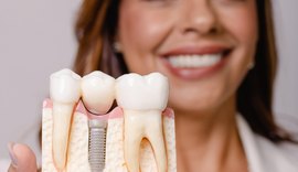 Dia da Saúde: dentista alerta para os impactos das doenças bucais em todo o organismo