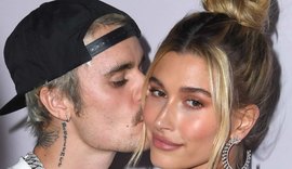Hailey, esposa de Justin Bieber, é internada com “danos cerebrais”