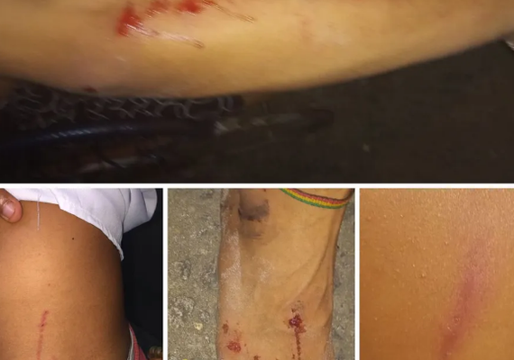 PC investiga denúncia de agressão contra três jovens  por alunos do Curso de Formação da Polícia Militar
