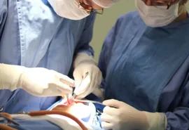 Fissura labiopalatina demanda tratamento precoce e multidisciplinar