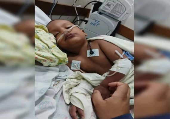 Criança de 2 anos está em estado grave após picada de escorpião