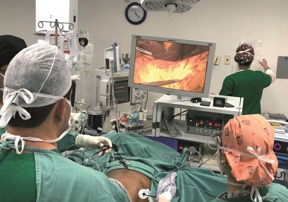 Hospital Universitário realiza cirurgias inéditas para retirada de tumores