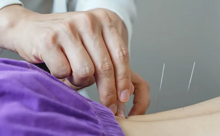 Brasil regulamenta exercício profissional da acupuntura