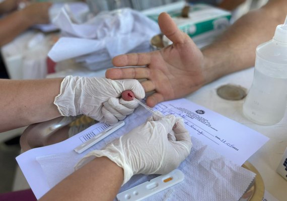 Farmácias agora podem fazer exame de análise clínica