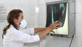 Brasil se aproxima de padrão positivo de combate à tuberculose, mostra relatório
