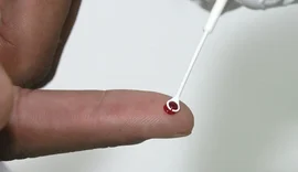 Fiji declara emergência nacional por HIV com 1 caso a cada 60 pessoas