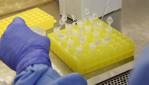 Ministério da Saúde: Brasil tem 1,3 mortes e 23,4 mil casos confirmados de Covid-19