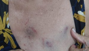 Mulher denuncia companheiro por enforcamento e agressões na Serraria