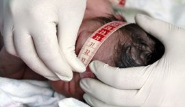 'Ciranda do Cuidado' garante assistência a bebês com microcefalia em Maceió