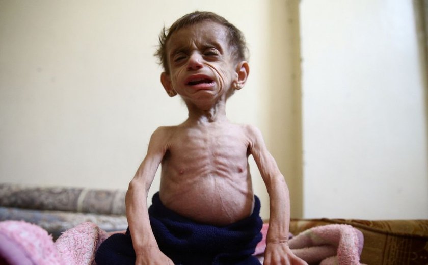 Chefe de direitos humanos da ONU denuncia fome em cerco na Síria