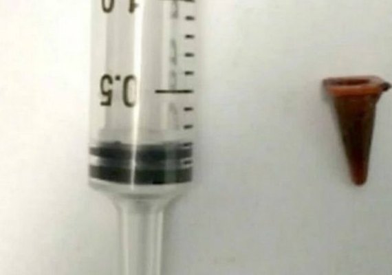 Homem passa 40 anos com peça de brinquedo presa no pulmão