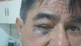 Ex-prefeito de Olivença é agredido em confusão no Centro da cidade