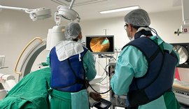 Hospital realiza 1ª colangiopancreatografia endoscópica pelo SUS