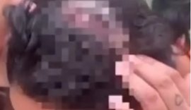 Homem ataca ex com golpes de foice na cabeça em Junqueiro