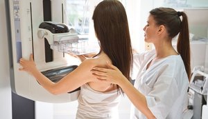 Sesc disponibiliza 3 mil vagas gratuitas para exames de mamografia e citologia