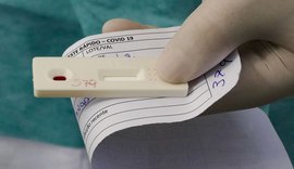 Alagoas registra 572 novos casos de Covid-19 e mais cinco mortes nesta quinta-feira (3)