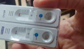 Governo inclui procedimento na tabela do SUS e amplia detecção rápida do Zika