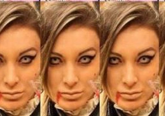 Andressa Urach posta novo antes e depois e choca internautas