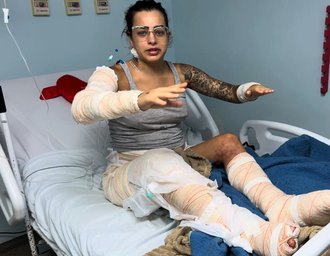 Vídeo: gasolina pode ter causado incêndio que fez vítima fatal em Maceió