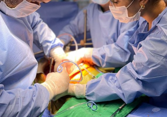 Santa Casa de Maceió realiza 4º transplante de fígado