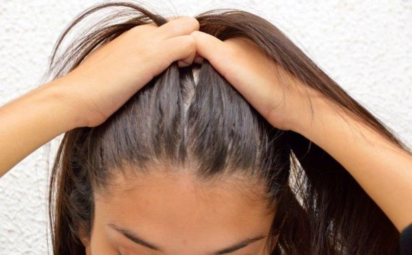 Dermatologista explica diferença entre queda de cabelo e calvície
