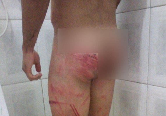 Justiça aceita denúncia contra militares suspeitos de torturar soldado
