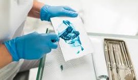 Número de vítimas de dentista que aplicou silicone industrial em Arapiraca sobe para cinco