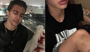 Biel é acusado de agredir mulher e divulga vídeo da briga