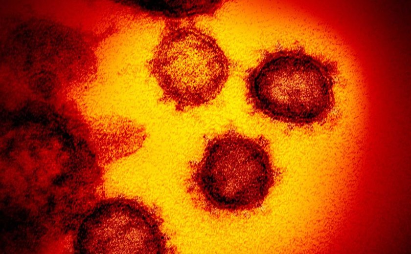 Brasil registra 42.619 novos casos de coronavírus e mais 1.220 mortes