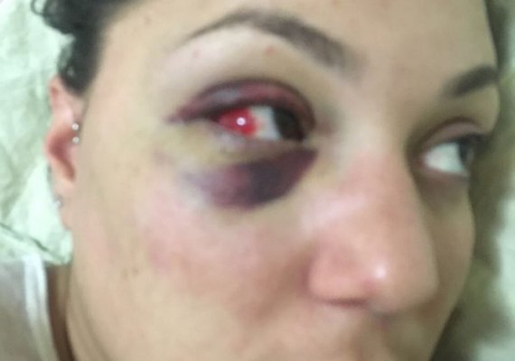 Noiva de Marlon Sandro relembra agressão pelo lutador: 'Me apagou no meio-fio'