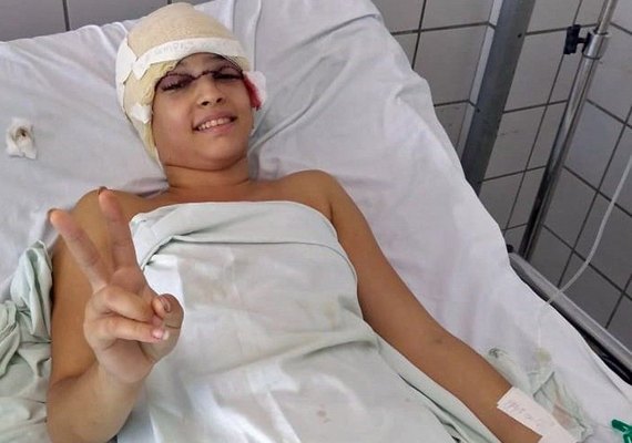 Jovem que teve couro cabeludo arrancado em kart é transferida do Recife para SP
