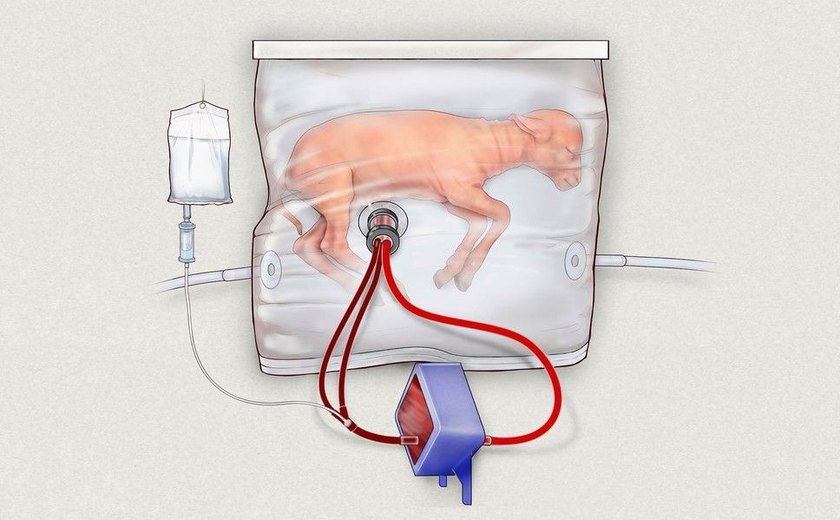 Cientistas desenvolvem útero artificial para ajudar bebês prematuros