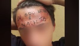 Campanha arrecada R$ 13 mil em um dia para remover tatuagem da testa de jovem