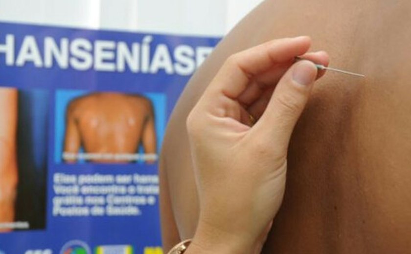Dia Nacional de Combate e Prevenção da Hanseníase: Brasil teve mais de 17 mil casos da doença em 2022
