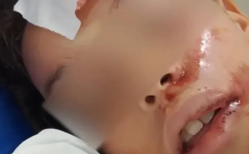 Polícia Civil apura dois casos de possíveis agressões contra crianças em Maceió