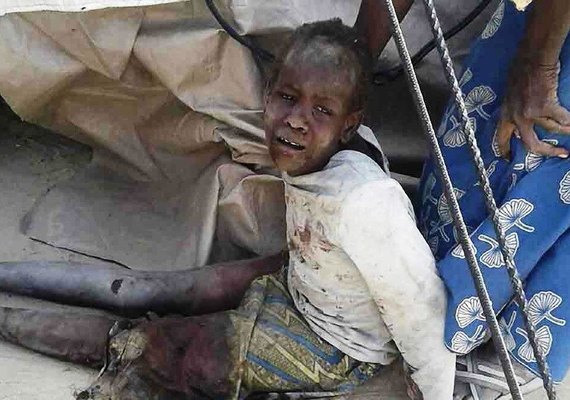 Nº de mortos em ataque a campo de refugiados na Nigéria sobe para 70