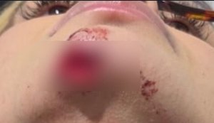 Influenciadora denuncia ex por agressão e afirma ter sido arrastada por carro em Maceió