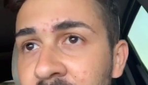 Carlinhos Maia elogia atendimento no JÁ em Arapiraca