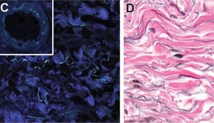 Interstício, o 'novo órgão' do corpo humano que a ciência acaba de descobrir