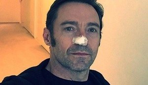 Hugh Jackman é submetido a novo tratamento contra câncer de pele