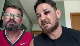 Turista agredido em Porto de Galinhas diz que violência foi maior por ser casal gay