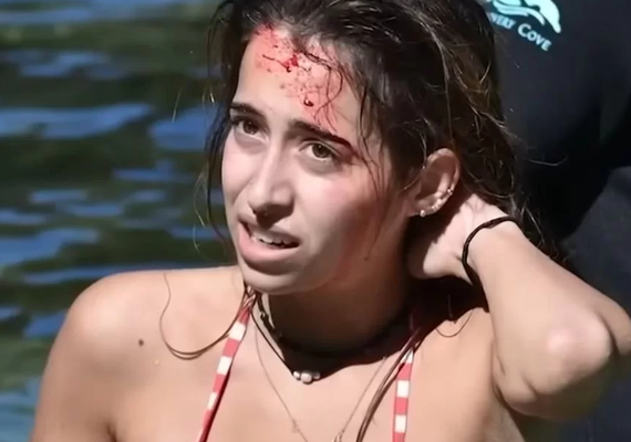 Mulher é mordida na cabeça por crocodilo e sobrevive