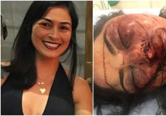 Mulher é agredida e abandonada em estrada pelo companheiro