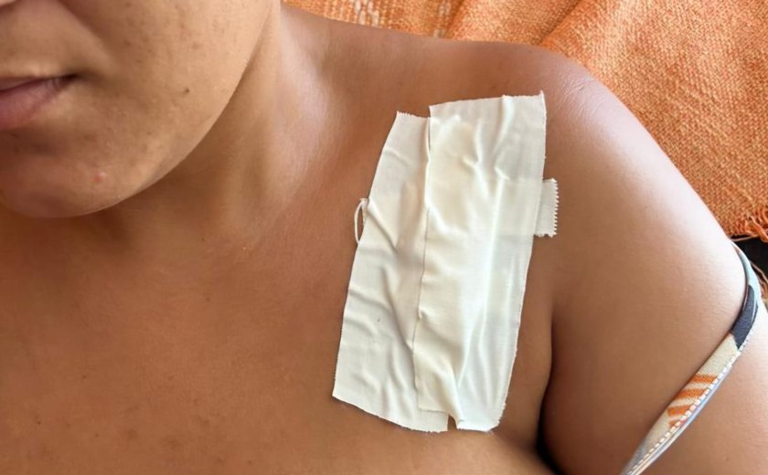 Mulher denuncia tentativa de feminicídio e diz ter sido atacada pelo ex em Murici