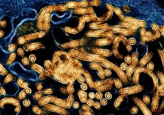 Organização Mundial da Saúde declara surto de ebola na África: “Emergência global”