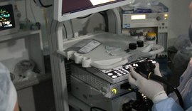 Alagoas terá Centro de Ensino e Treinamento em Endoscopia Digestiva