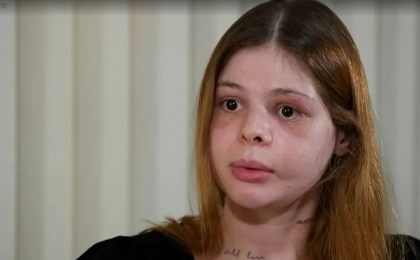 Médica agredida por ex-namorado fisiculturista perde visão parcial e rosto 'desfigurado'